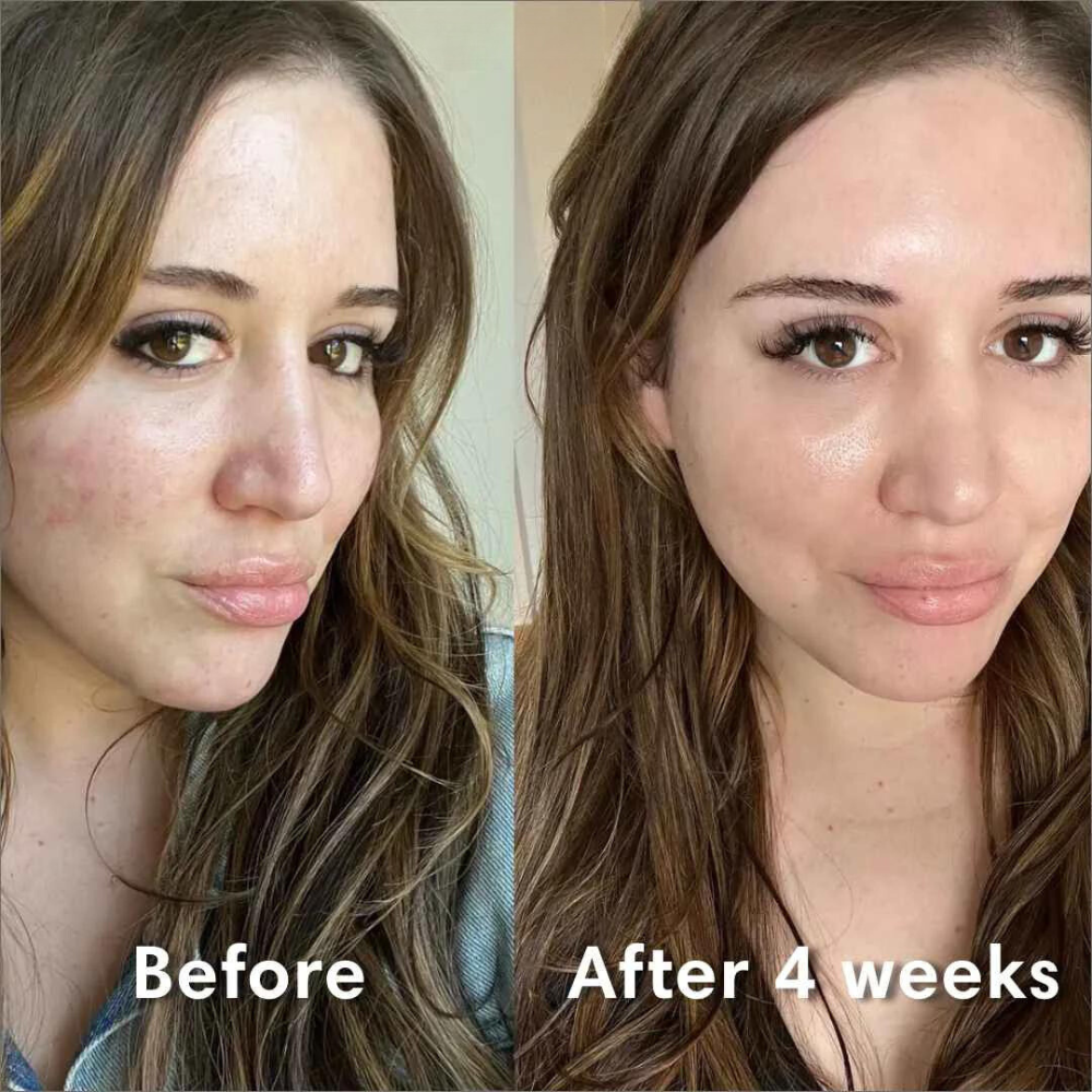 Radiant Glow Bio-Collagen Mask