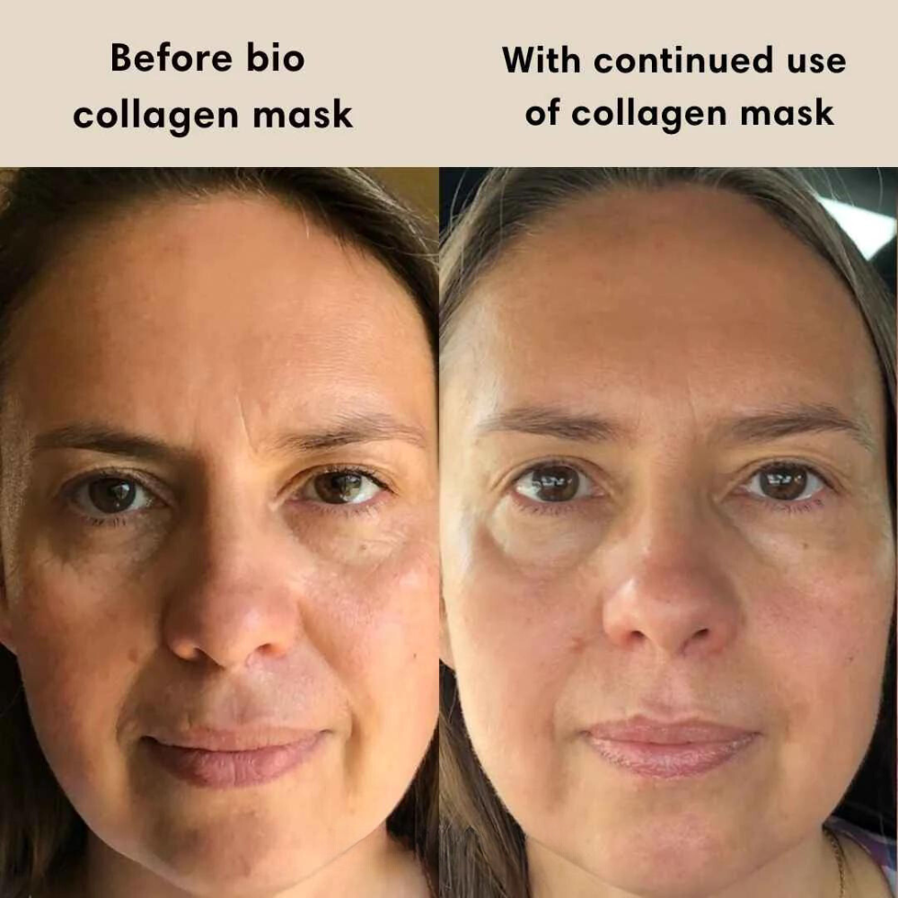 Radiant Glow Bio-Collagen Mask