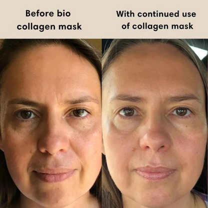 Radiant Glow Bio-Collagen Mask